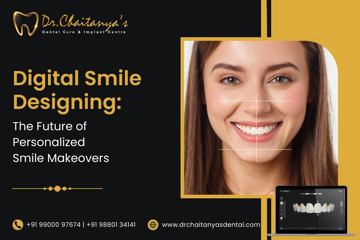 Digital Smile Designing: The Future Of Personalized Smile Makeovers