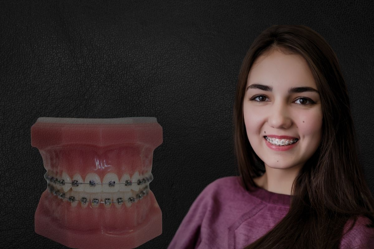 braces-treatment