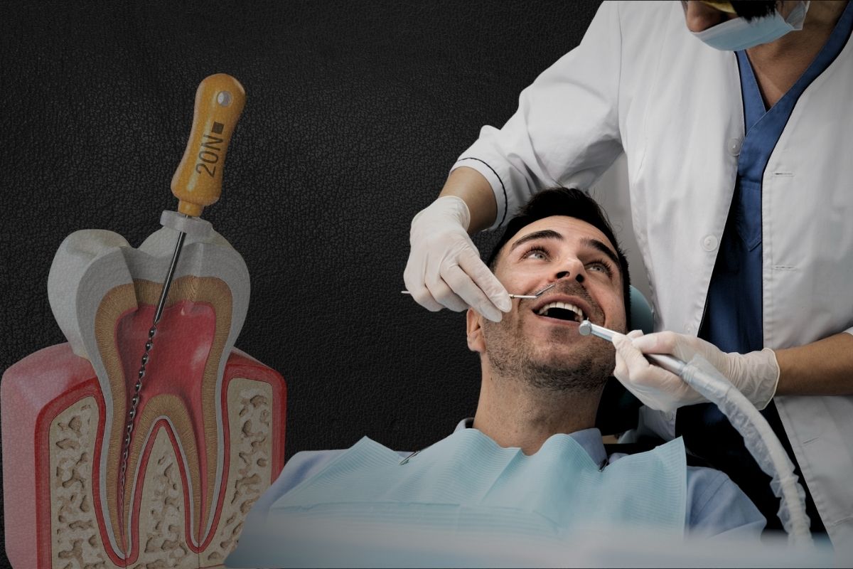 single-sitting-root-canal-treatment